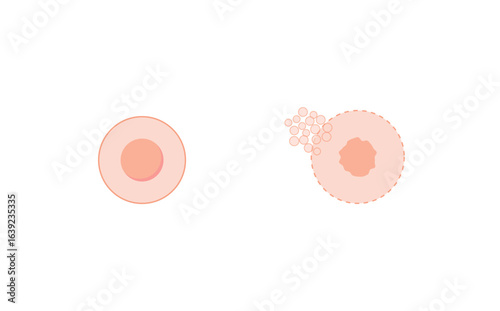 Necrosis, Pathologic Cell Death, vs normal cell. Vector illustration	