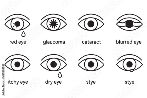 eye health medical icons showing conditions such as red eye, glaucoma, cataract, dry eye, blurry vision, stye, and itchy eye, glaucoma and eye care illustration