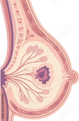 Cross-section illustration of a breast, highlighting internal structures and a possible tumor.