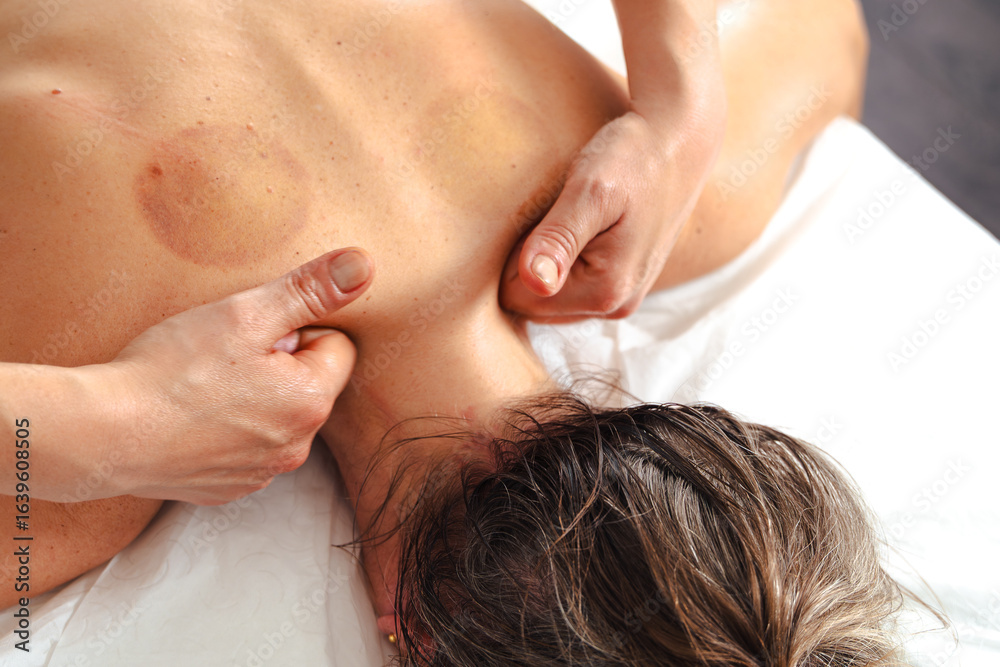 Fototapeta premium Close up shot of a massage therapist hands applying gentle pressure to a clients upper back on a white massage table indoors, muscle relaxation and wellness in a calm spa environment today 