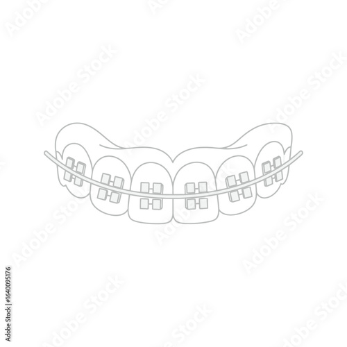 Illustration of a set of teeth with braces, showing the brackets and wire, in a minimalist style.