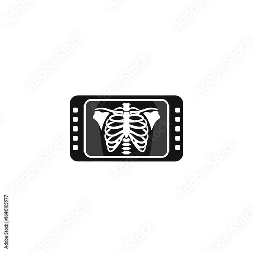 X-ray image of ribs displayed on a screen, medical diagnostics.