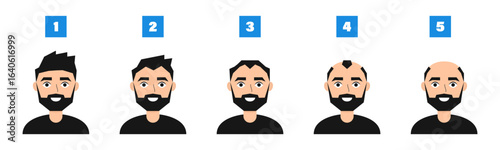 Male pattern hair loss. Stages of baldness in men. Vector