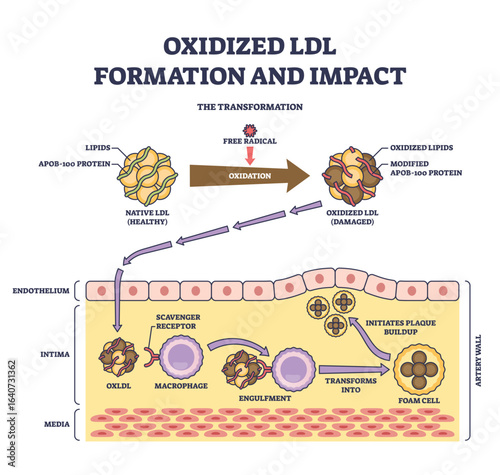 Oxidized LDL formation and impact shows LDL oxidation, macrophage engulfment, and foam cell creation in artery wall. Outline diagram
