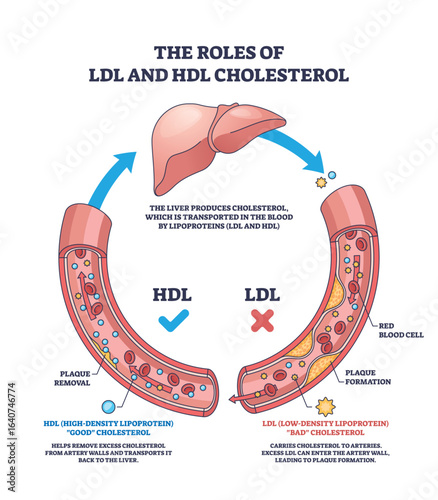 The roles of LDL and HDL cholesterol are shown with a liver, blood vessels, and cholesterol particles, highlighting cholesterol transport and plaque formation. Outline diagram