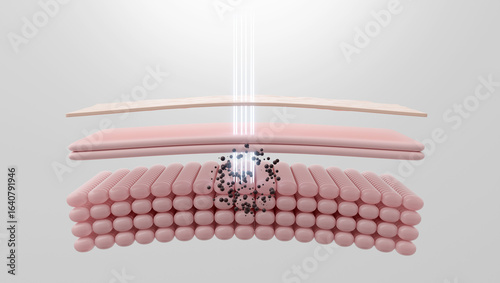 Принти на полотні Pico laser shattering pigmentation for dark spot removal 3D