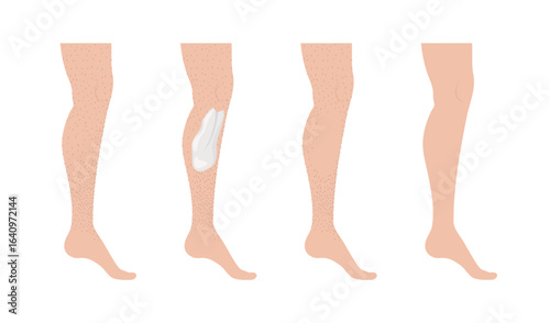 Hair removal cream being applied on hairy legs