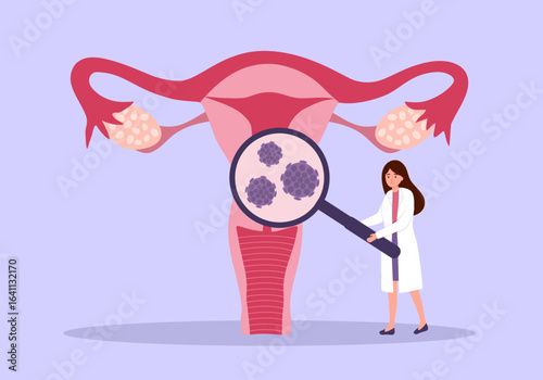 HPV (Human Papillomavirus) Cervical cancer screening and treatment. Doctor diagnosis HPV virus in uterus.