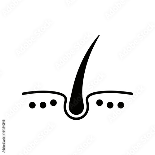 Illustration of a hair follicle showing hair growing from the skin layer and root structure
