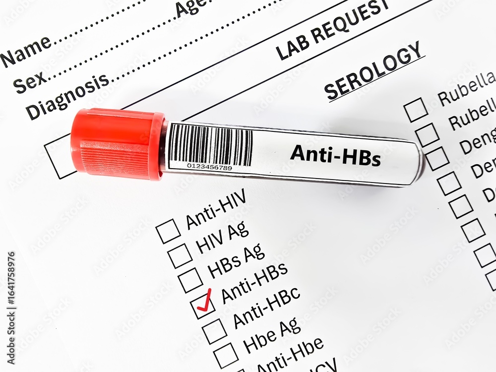 Obraz premium Blood sample tube and paper order request for anti-HBs test analysis.