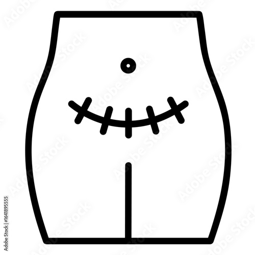 Female Abdomen with Surgical Stitches after Cesarean Section. Medical Postpartum Recovery, Maternal Health, Obstetric Surgery, and Perinatal Care