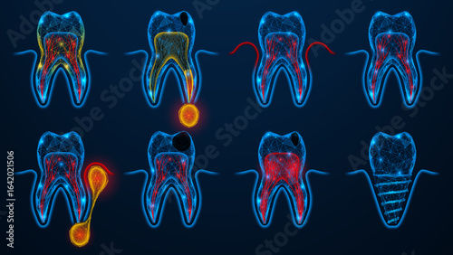 Conditions and various dental diseases. Foci of inflammation and pathological changes. Polygonal design of lines and dots. Dark blue background.