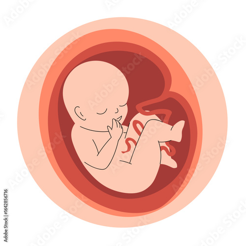 Fetus inside the womb, showing umbilical cord and fetal position.
