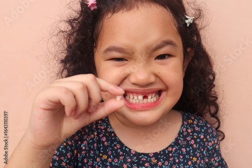 Asian girl with curly hair smiling proudly showing her missing tooth, close up and pink background.