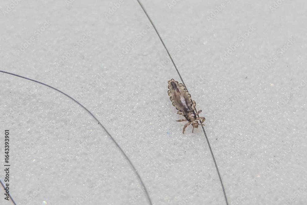 Φωτογραφία Close-up of a head louse on a human hair, isolated on a white background, showing detailed anatomy and texture for medical and educational purposes
