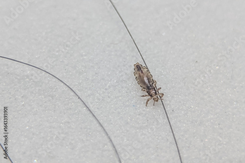 Billede på lærred Close-up of a head louse on a human hair, isolated on a white background, showing detailed anatomy and texture for medical and educational purposes