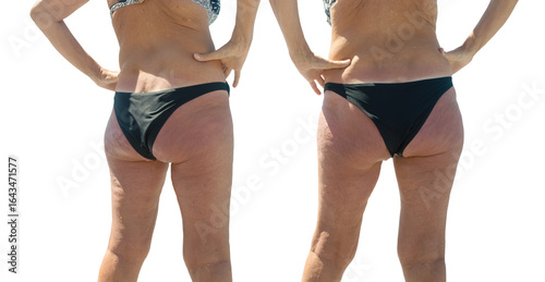 two slender female figures in swimsuits on a white background