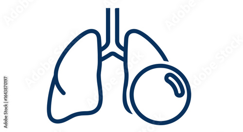 Lung Cancer Illustration with Tumor on Right Lung