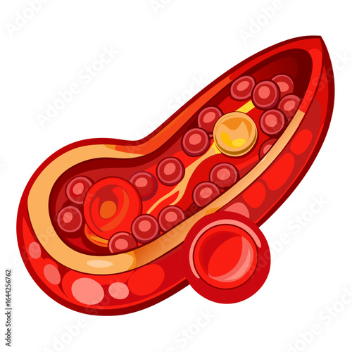 Flowing Red Blood Cells in Artery — World Hemophilia Day Medical Vector