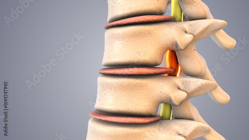 Spinal Decompression Therapy Explained in Medical Animation