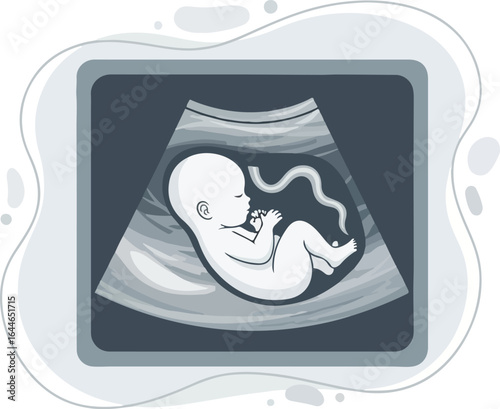 Ultrasound Scan Depicting Fetus in Womb Illustration.