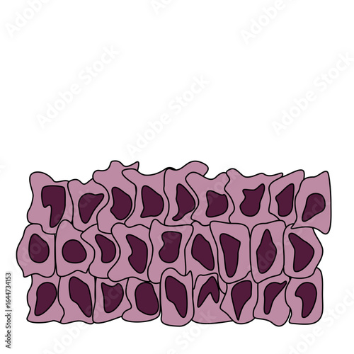 cancer cells illustration, hyperplasia and dysplasia. Mutated cells. The spread of cancer cells. Medical vector illustration, poster or science study.