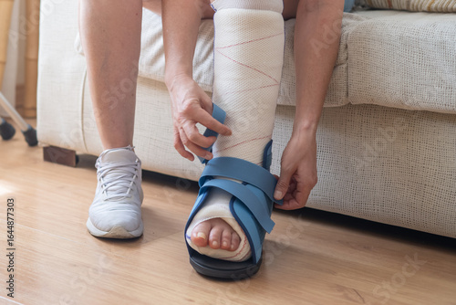 Bild auf Leinwand Close-up of a patient fastening the straps of an orthopedic boot, showcasing the