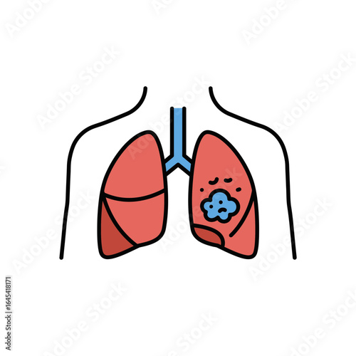 Understanding Lung Health: An insightful illustration highlighting the human lung, depicting a medical scenario, providing a visual representation of respiratory health.