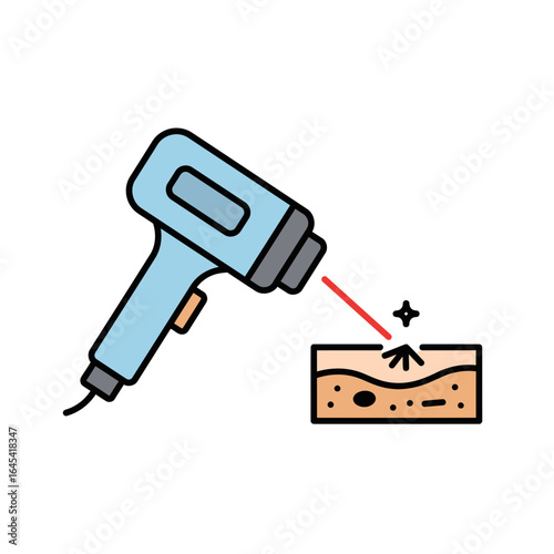Laser Skin Treatment: A detailed illustration depicts a laser skin treatment, a cutting-edge approach to skincare, targeting a specific blemish with precision and accuracy.