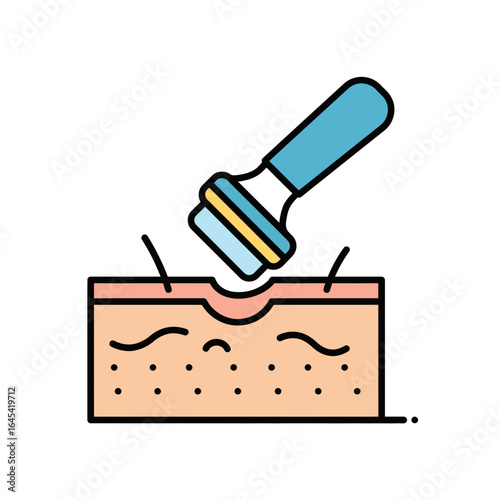 Skin Care Innovation: An illustrative depiction of a skin resurfacing procedure with detailed cross-section, showing treatment of skin texture and collagen production.