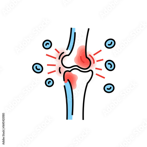 Arthritis Illustration: A stylized illustration showcases a detailed representation of the human knee joint, highlighting areas of inflammation, redness, and other associated health issues.