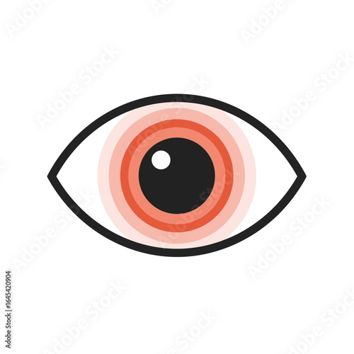 Inflamed Eye: Medical Illustration of irritated eye, showcasing the red rings of inflammation surrounding the pupil. The artwork clearly communicates medical concept.