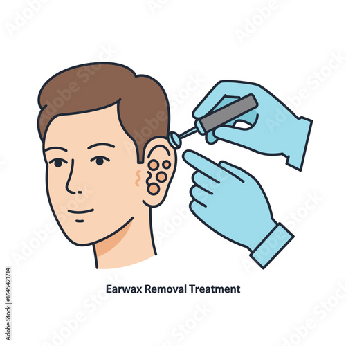 Gentle Ear Cleaning: An illustrated view of an ear cleaning procedure, showcasing a health professional's expertise. 