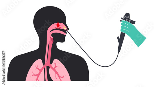 Nasal endoscopy poster