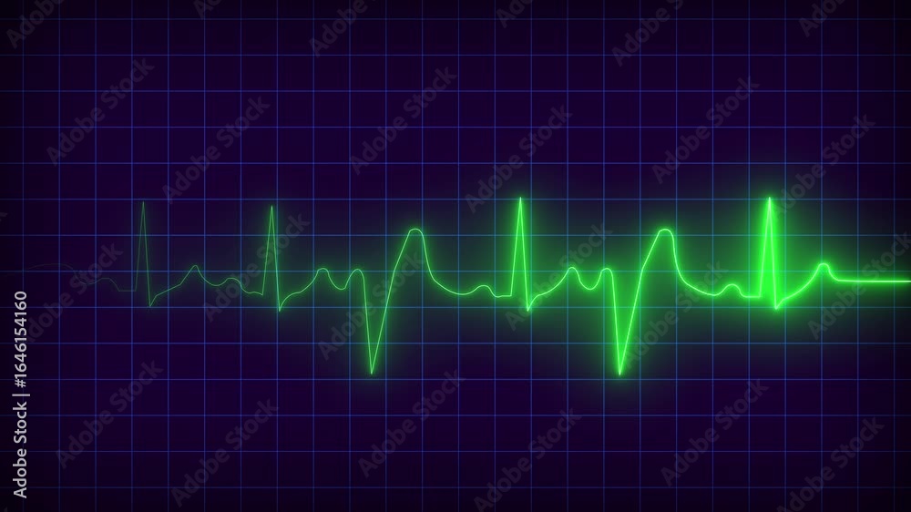 Neon Green Heartbeat E K G Line on Dark Grid Background Medical Science Technology Concept Neon Green Heartbeat E K G Line on Dark Grid Background Medical Science Technology Concept