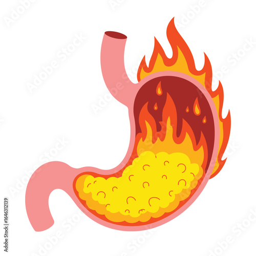 Illustration of a stomach on fire representing heartburn or indigestion
