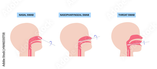 swab medical procedure