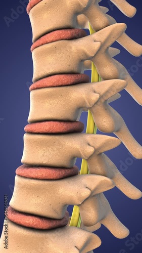 Medical Visualization of Spinal Decompression Procedure