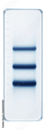 Distinct pattern of three closely spaced bands in a gel lane