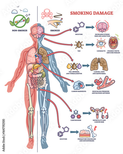 Smoking damage diagram shows human body outline, highlighting organs, arrows, and harmful effects of smoking. Outline diagram