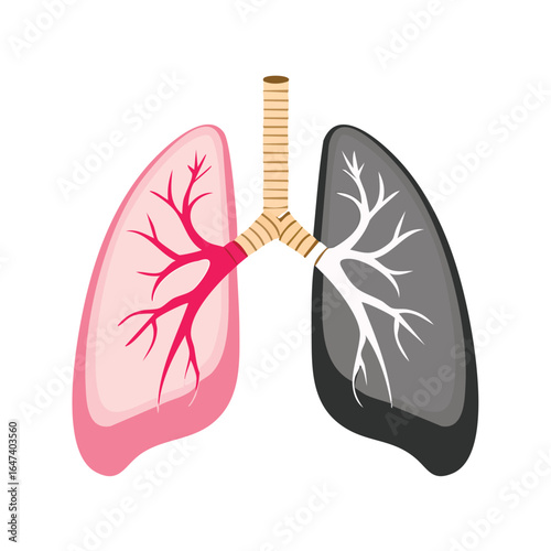 Illustration depicting healthy and damaged lungs, highlighting the effects of smoking and disease on respiratory health.