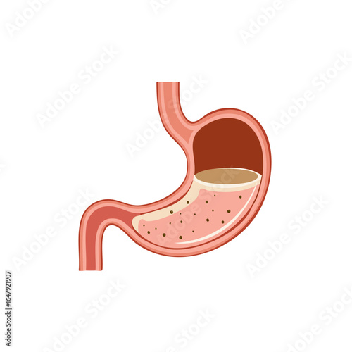 Detailed medical illustration of the human stomach showing digestive process with food particles