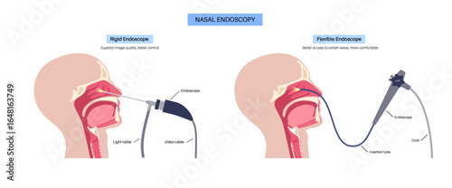 Nasal endoscopy poster