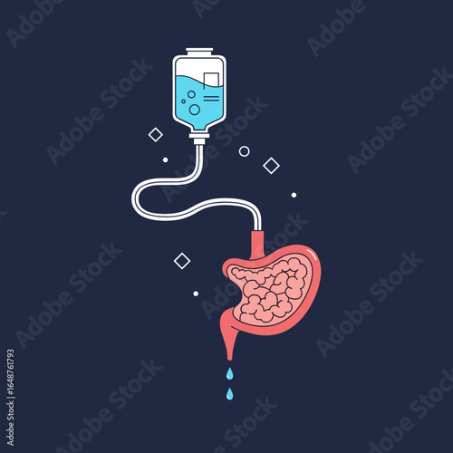 Understanding intravenous fluid therapy and its role in gastric health and digestion support
