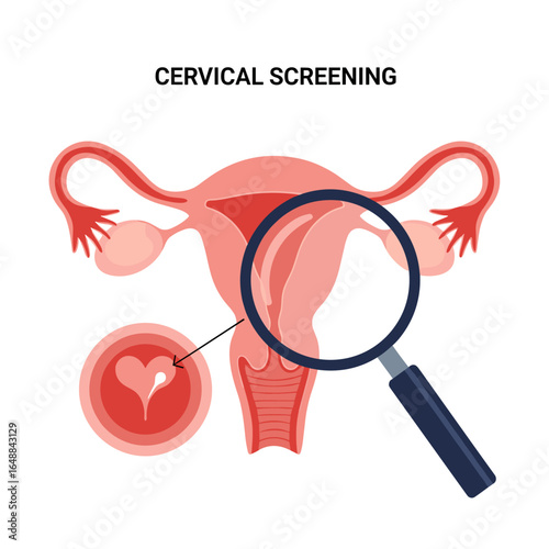 Understanding cervical screening the importance of early detection and prevention for women's health
