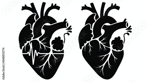 Human Heart Anatomy Illustration Featuring Healthy and Diseased Hearts Medical Concept in Black and White High Contrast Graphic Design Visual for Healthcare Presentations
