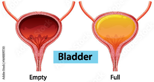 Human Bladder Illustration: Empty and Full States