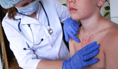 Konstfotografi The physician is inspecting the child's skin for signs of monkeypox