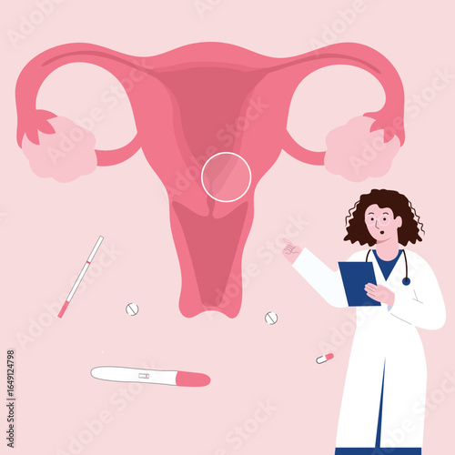 Illustration of a doctor explaining about Endometrial Hyperplasia