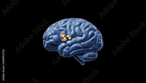 3D model of a human brain, side view, with highlighted activity clusters